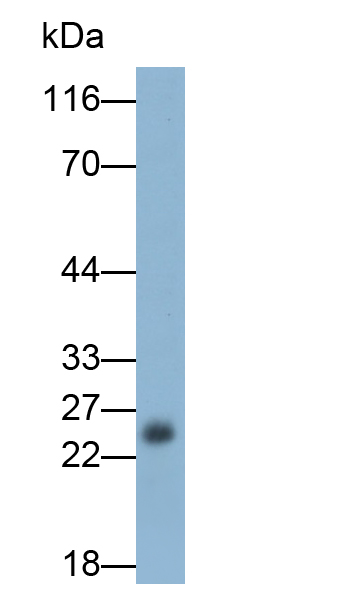 Monoclonal Antibody to Twist Transcription Factor (TWIST)