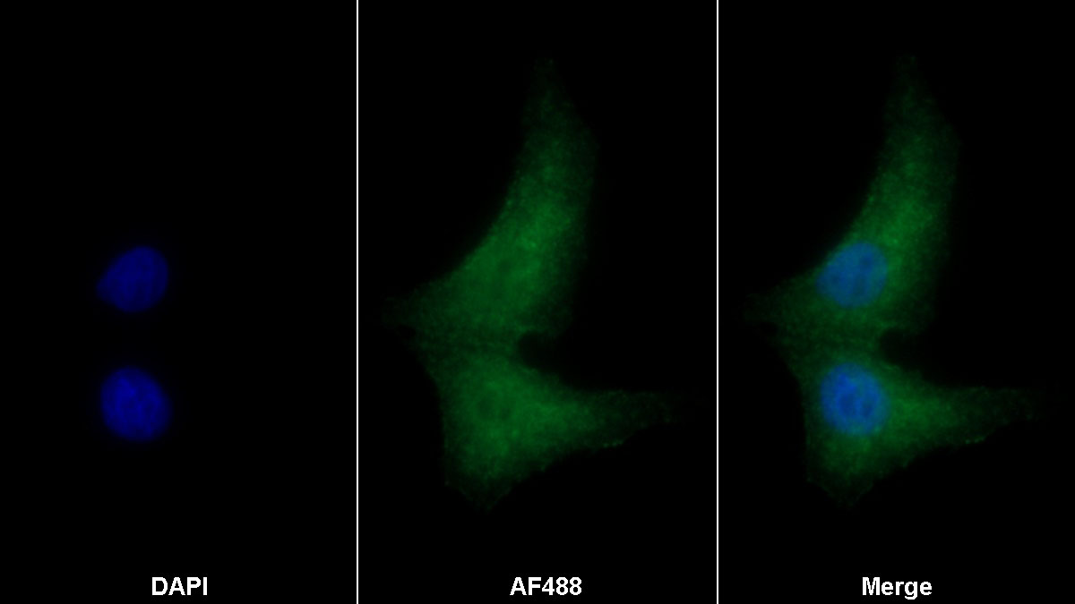 Monoclonal Antibody to Peptidase Inhibitor 3, Skin Derived (PI3)