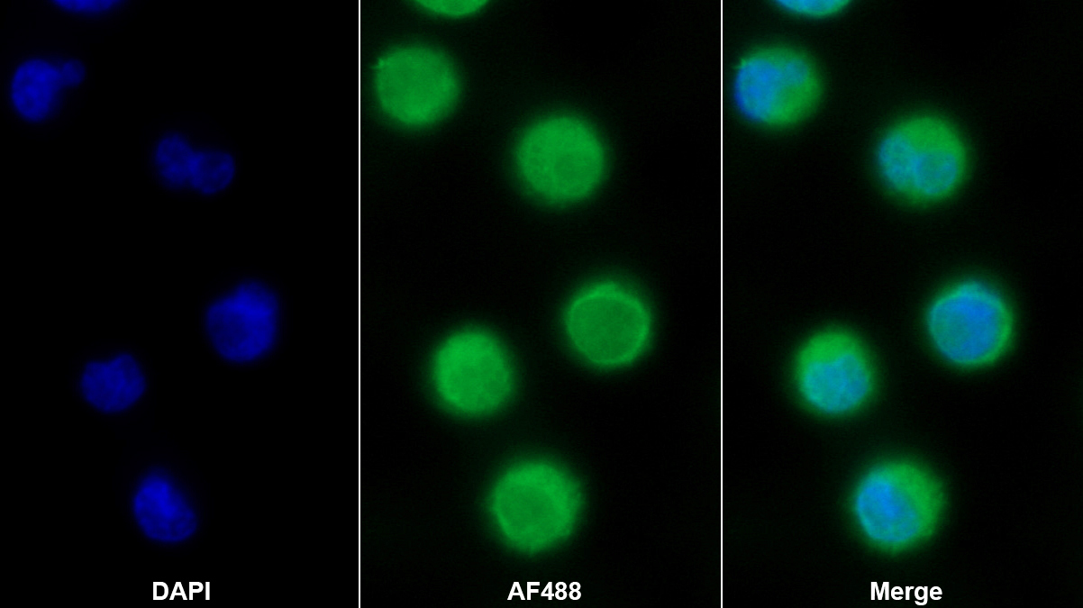 Monoclonal Antibody to Stanniocalcin 1 (STC1)