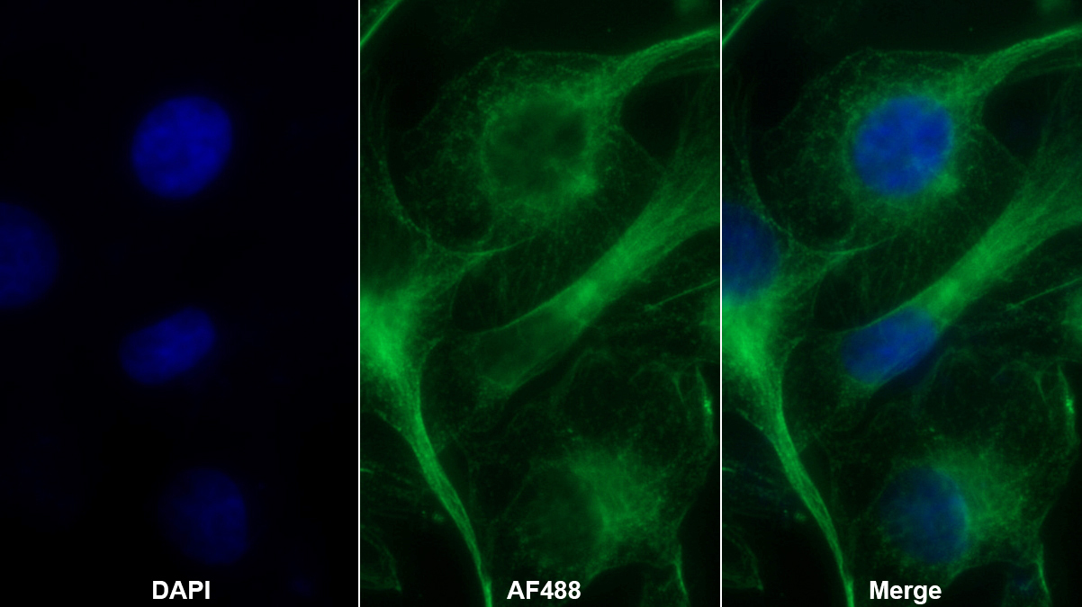 Monoclonal Antibody to Fibroblast Growth Factor 13 (FGF13)