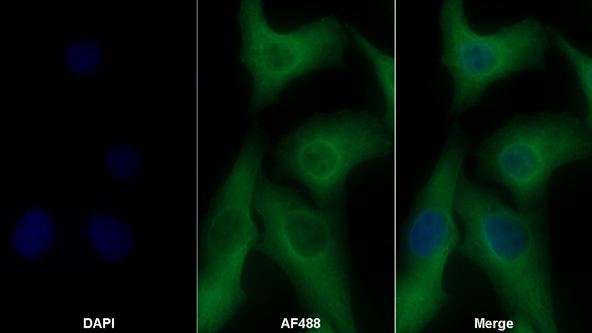 Monoclonal Antibody to Fibroblast Growth Factor 21 (FGF21)