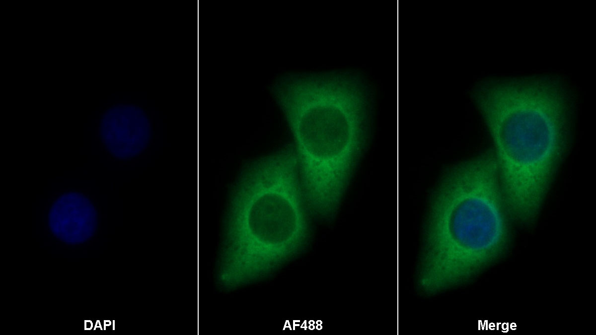 Monoclonal Antibody to Fibroblast Growth Factor 21 (FGF21)