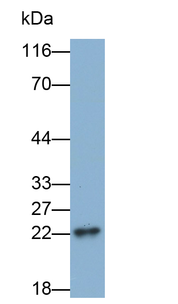 Monoclonal Antibody to Crystallin Alpha B (CRYaB)