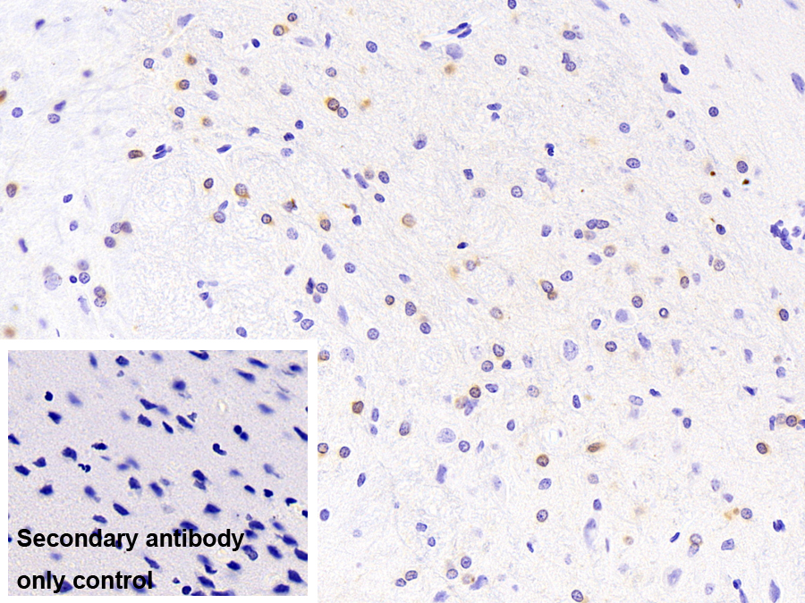 Monoclonal Antibody to Crystallin Alpha B (CRYaB)