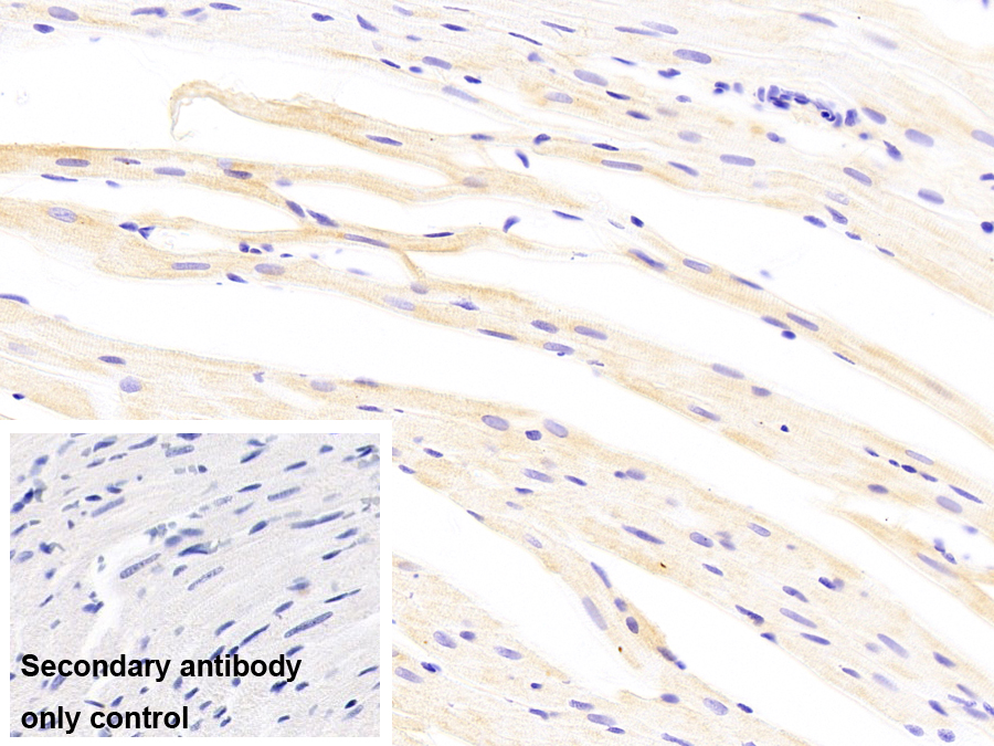 Monoclonal Antibody to Crystallin Alpha B (CRYaB)