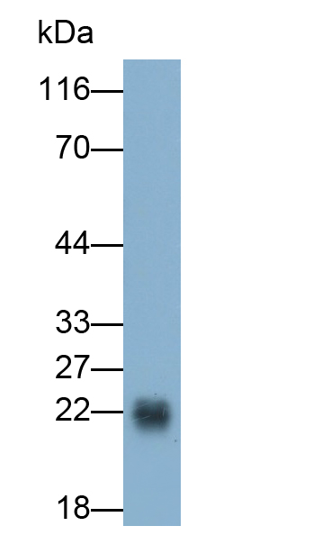 Monoclonal Antibody to Crystallin Alpha B (CRYaB)