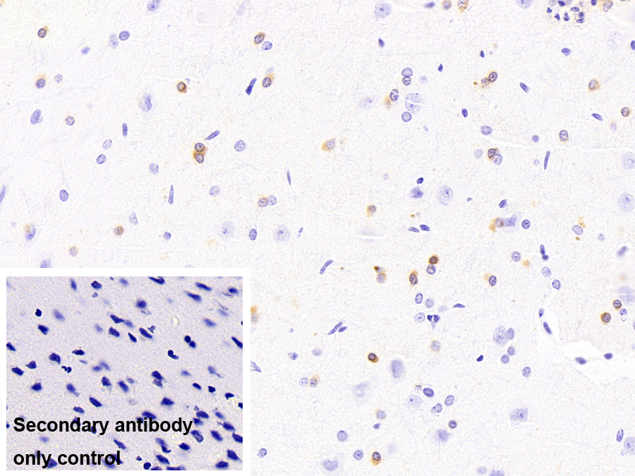 Monoclonal Antibody to Crystallin Alpha B (CRYaB)