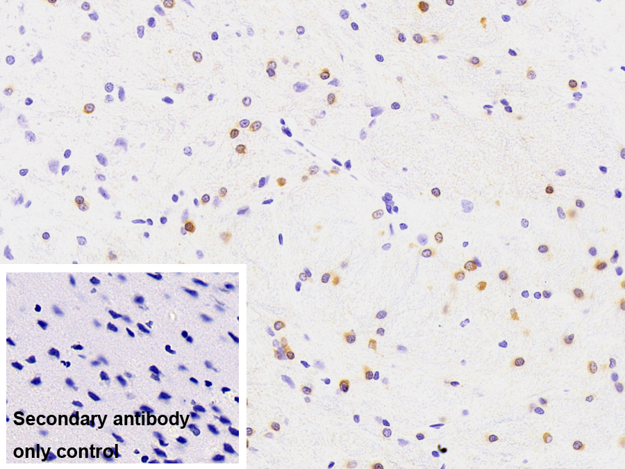Monoclonal Antibody to Crystallin Alpha B (CRYaB)