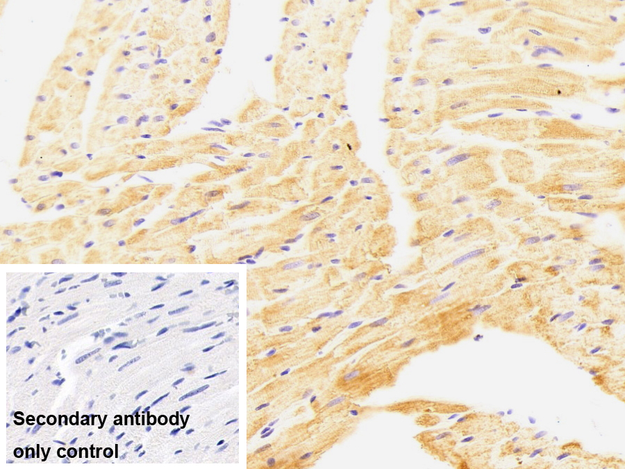 Monoclonal Antibody to Crystallin Alpha B (CRYaB)