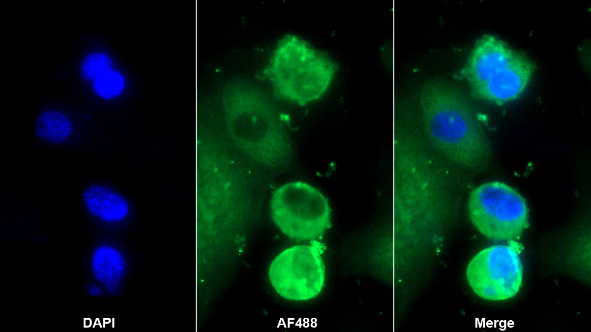 Monoclonal Antibody to Carcinoembryonic Antigen Related Cell Adhesion Molecule 3 (CEACAM3)