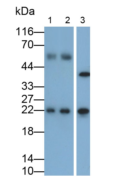 Monoclonal Antibody to Follicle Stimulating Hormone Beta (FSHb)