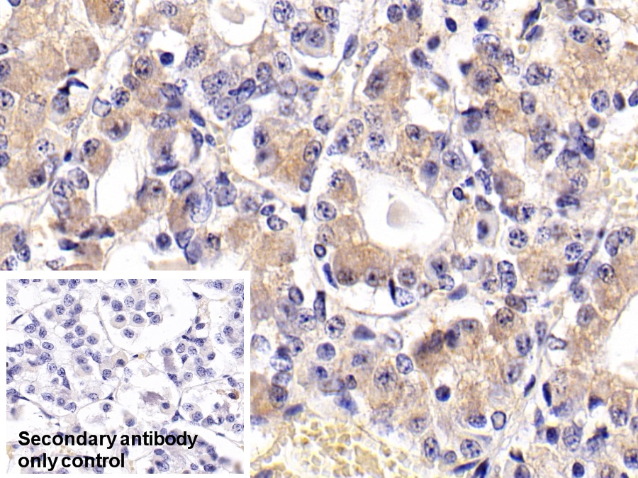 Monoclonal Antibody to Follicle Stimulating Hormone Beta (FSHb)