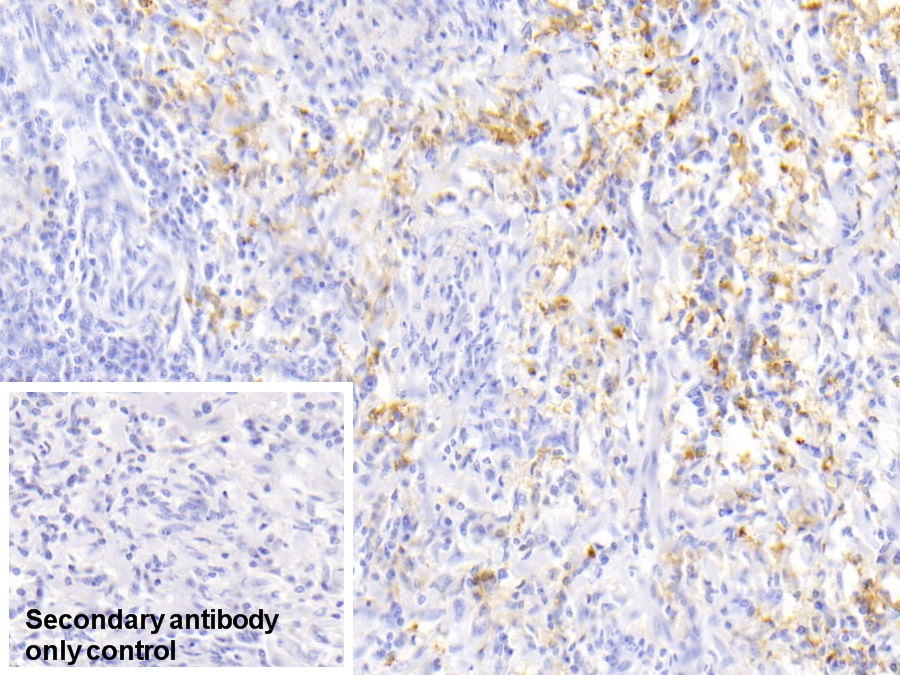 Monoclonal Antibody to Ferritin, Light Polypeptide (FTL)
