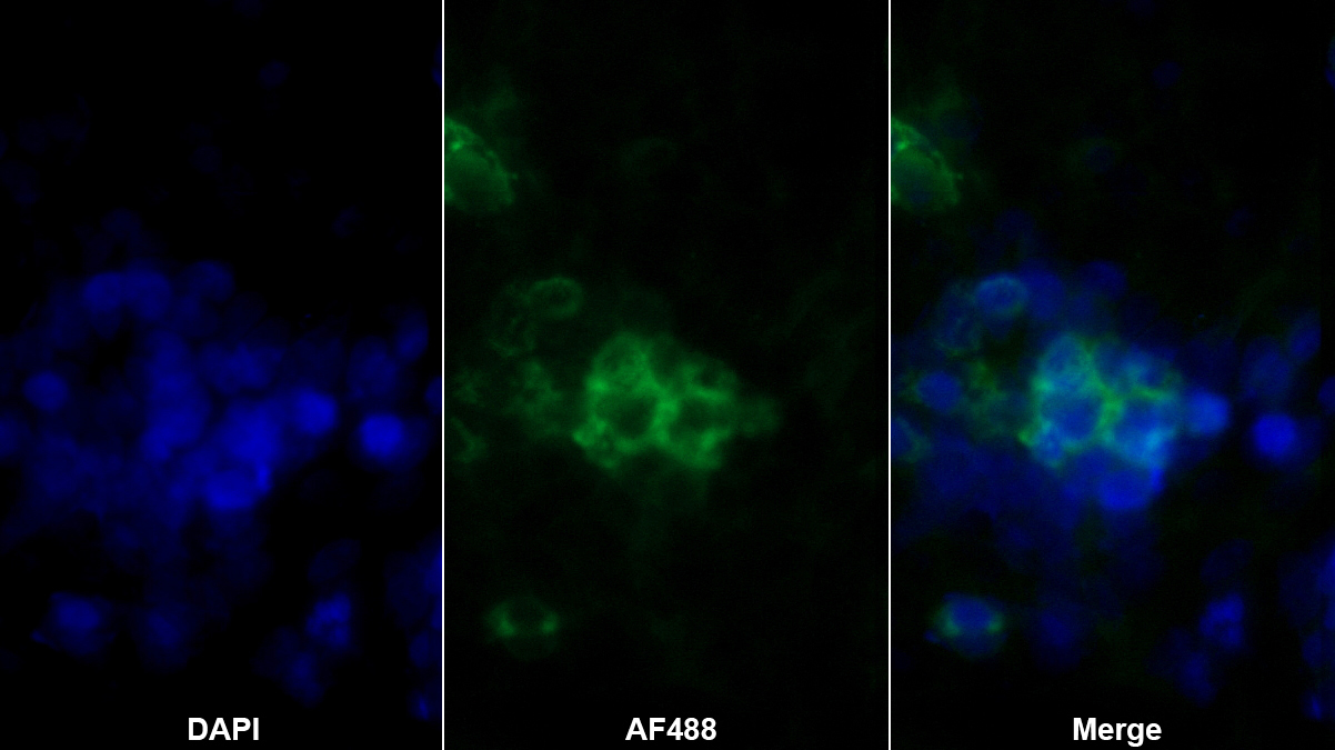 Monoclonal Antibody to Ferritin, Light Polypeptide (FTL)