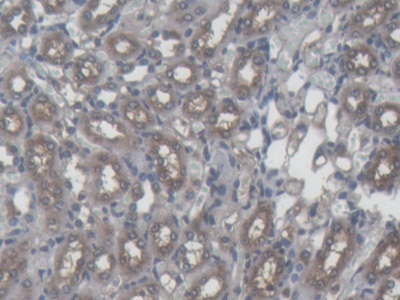 Monoclonal Antibody to Ferritin, Heavy Polypeptide (FTH)