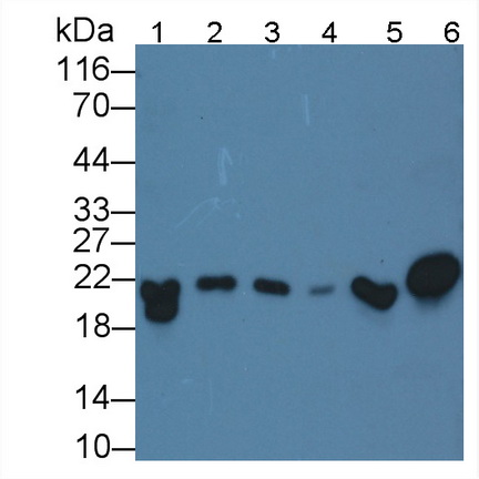 Monoclonal Antibody to Ferritin, Heavy Polypeptide (FTH)