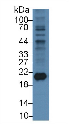 Monoclonal Antibody to Ferritin, Heavy Polypeptide (FTH)