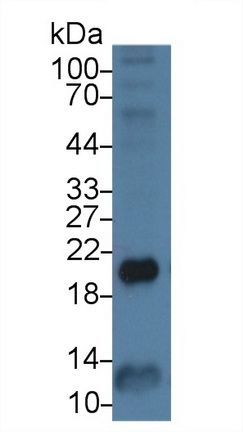 Monoclonal Antibody to Ferritin, Heavy Polypeptide (FTH)