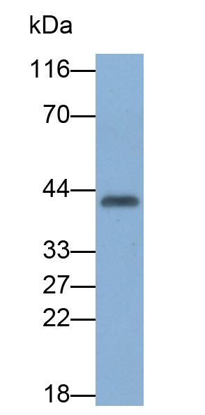 Monoclonal Antibody to Carbonic Anhydrase XII (CA12)