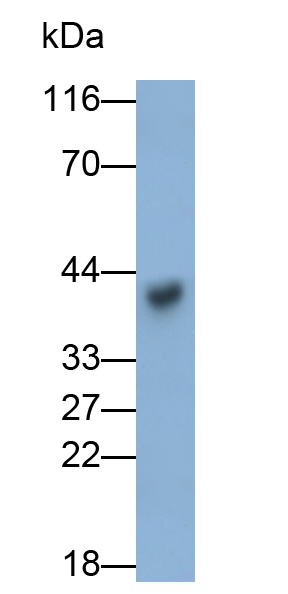 Monoclonal Antibody to Carbonic Anhydrase XII (CA12)