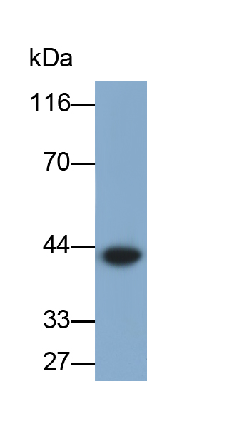 Monoclonal Antibody to Carbonic Anhydrase XII (CA12)