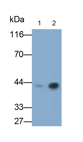 Monoclonal Antibody to Carbonic Anhydrase XII (CA12)