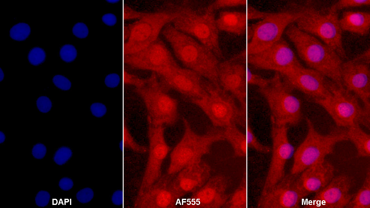 Monoclonal Antibody to Collagen Type II Alpha 1 (COL2a1)