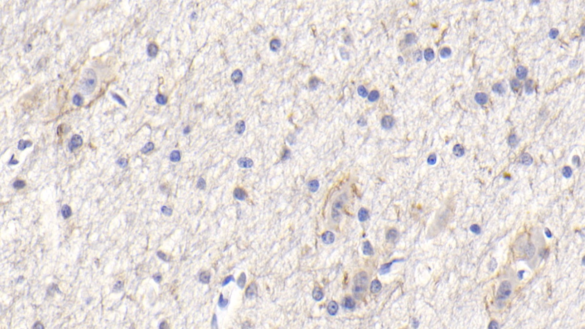 Monoclonal Antibody to Sequestosome 1 (SQSTM1)