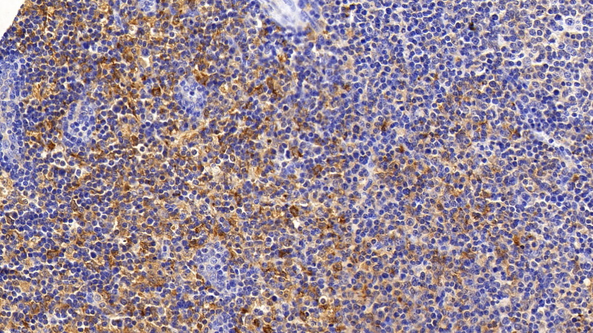 Monoclonal Antibody to Sequestosome 1 (SQSTM1)