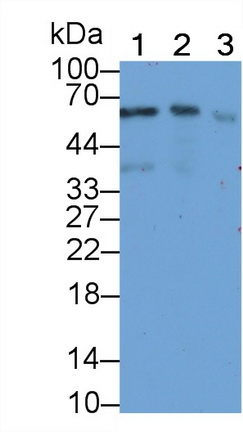 Monoclonal Antibody to Sequestosome 1 (SQSTM1)