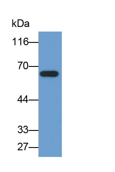 Monoclonal Antibody to Sequestosome 1 (SQSTM1)