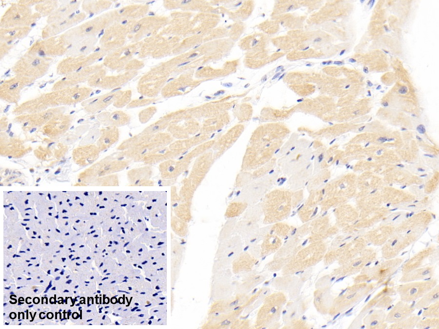 Monoclonal Antibody to Troponin T Type 2, Cardiac (TNNT2)