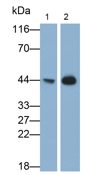 Monoclonal Antibody to Troponin T Type 2, Cardiac (TNNT2)