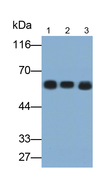 Monoclonal Antibody to Keratin 6A (KRT6A)