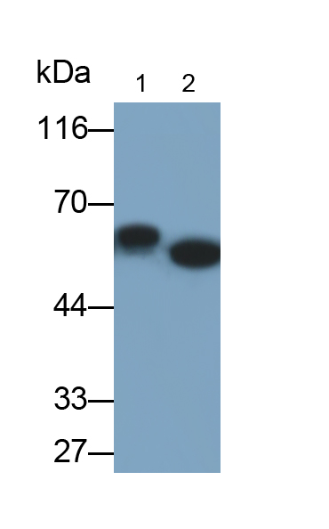 Monoclonal Antibody to Keratin 6A (KRT6A)