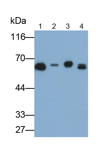 Monoclonal Antibody to Keratin 6A (KRT6A)