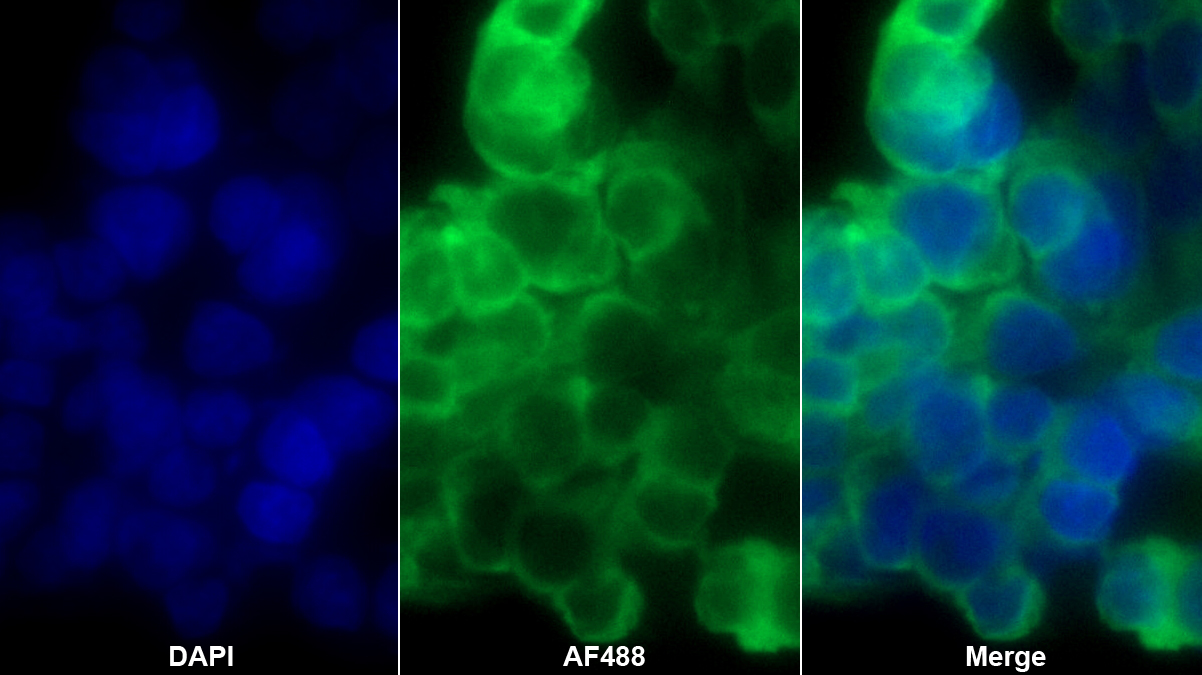 Monoclonal Antibody to Heat Shock Protein 90kDa Alpha B1 (HSP90aB1)
