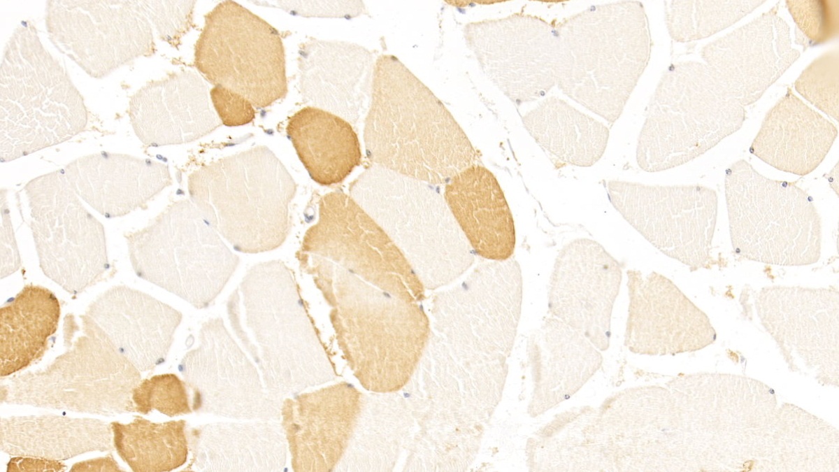 Monoclonal Antibody to Lipolysis Stimulated Lipoprotein Receptor (LSR)