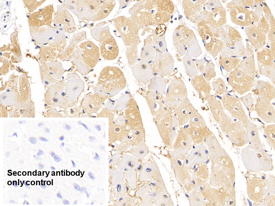 Monoclonal Antibody to Lipolysis Stimulated Lipoprotein Receptor (LSR)