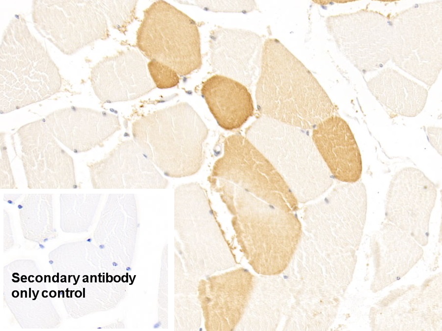 Monoclonal Antibody to Lipolysis Stimulated Lipoprotein Receptor (LSR)