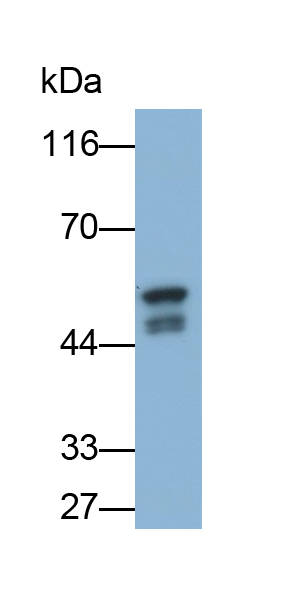 Monoclonal Antibody to Glutathione Synthetase (GSS)