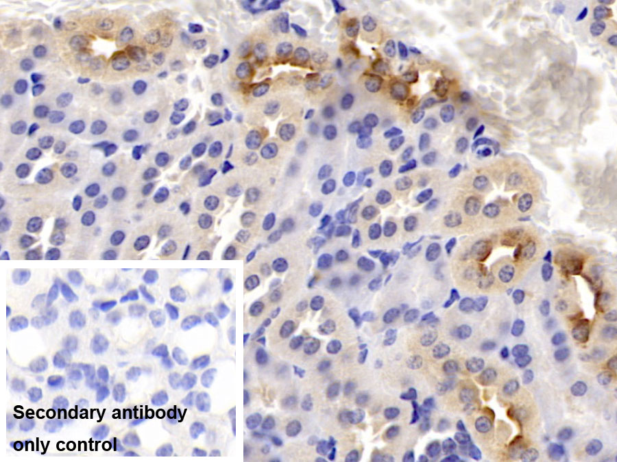 Monoclonal Antibody to Deoxythymidylate Kinase (DTYMK)