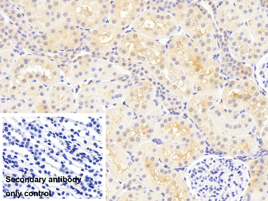 Monoclonal Antibody to Arginase II (Arg2)
