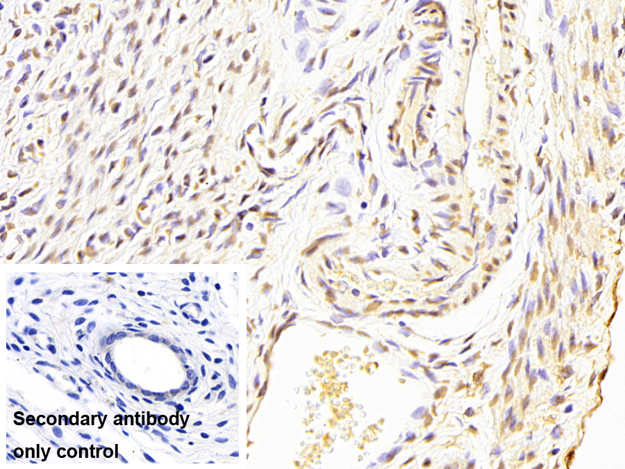 Monoclonal Antibody to Liver Receptor Homolog 1 (LRH1)