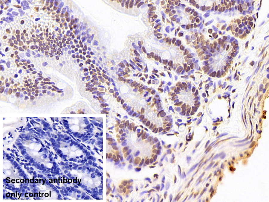 Monoclonal Antibody to Liver Receptor Homolog 1 (LRH1)