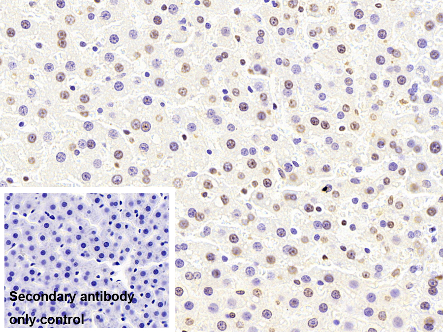 Monoclonal Antibody to Liver Receptor Homolog 1 (LRH1)