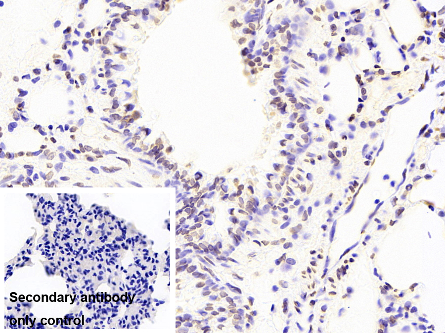 Monoclonal Antibody to Liver Receptor Homolog 1 (LRH1)