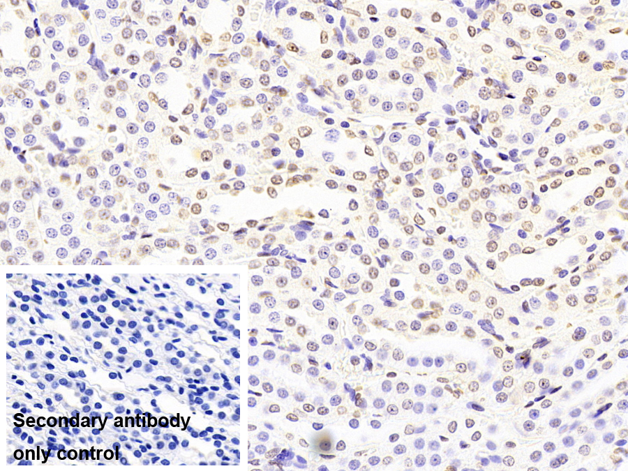 Monoclonal Antibody to Liver Receptor Homolog 1 (LRH1)