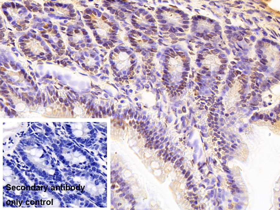 Monoclonal Antibody to Liver Receptor Homolog 1 (LRH1)