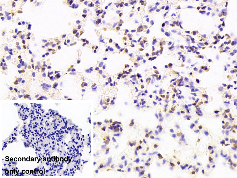 Monoclonal Antibody to Liver Receptor Homolog 1 (LRH1)